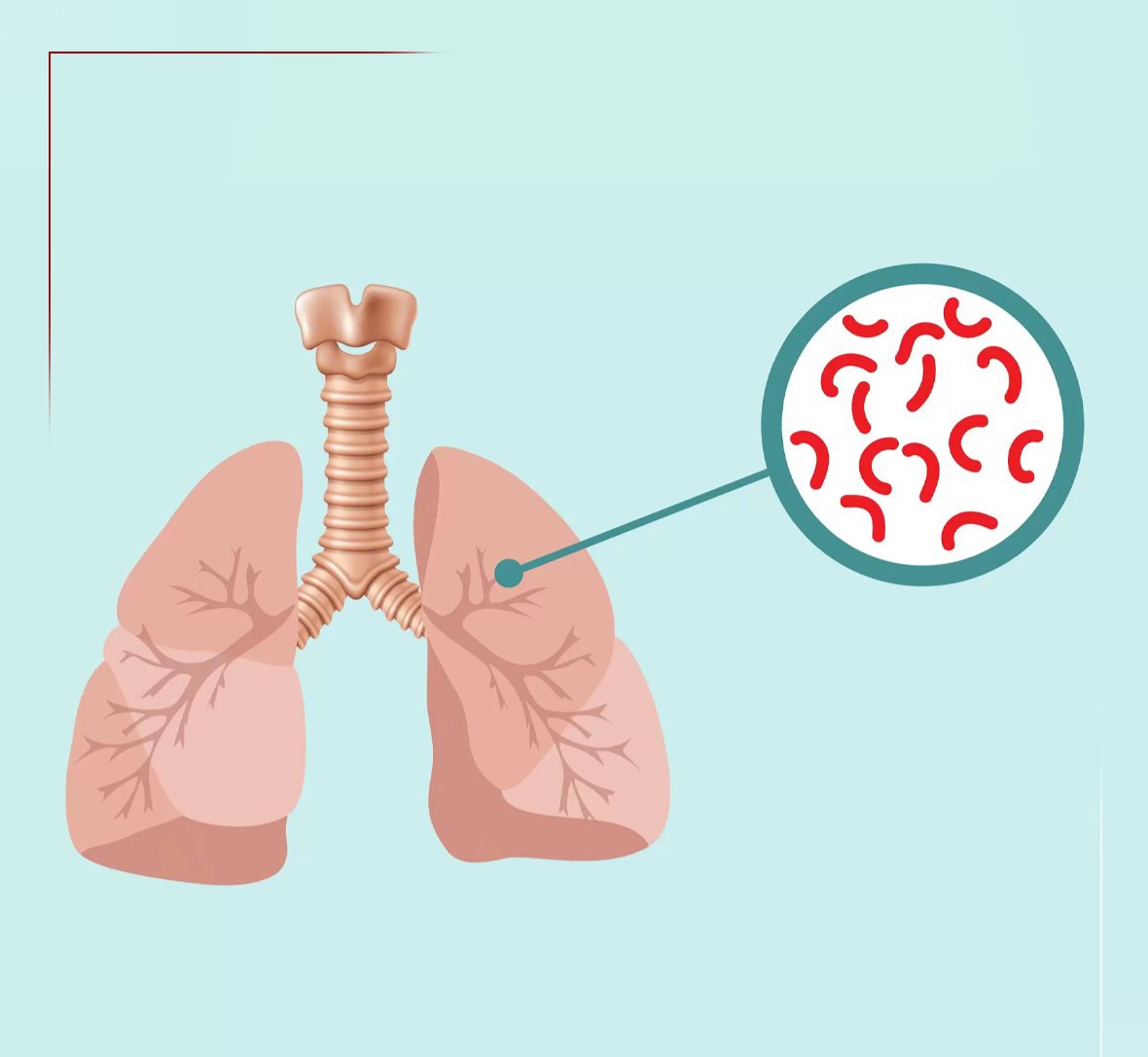 شناسایی ۶۵۶۵ مبتلا به سل در کشور!